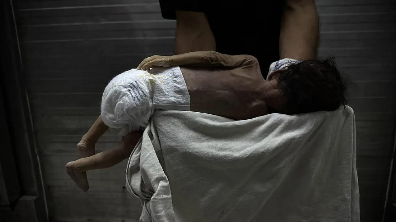 Gazze'nin En Masum Kurbanları! Yenidoğan Ünitesinde Görülmemiş Artış