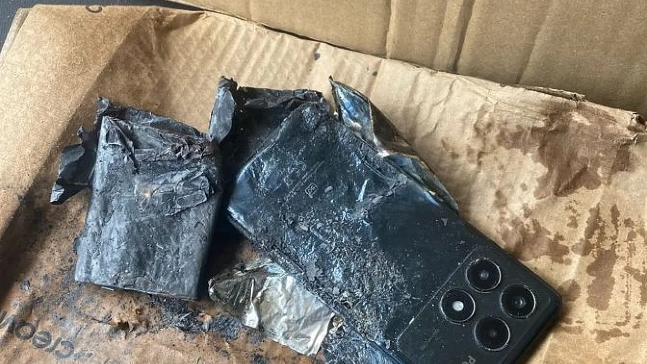Korkutan Olay! Cep Telefonu Bataryası Cebinde Patladı
