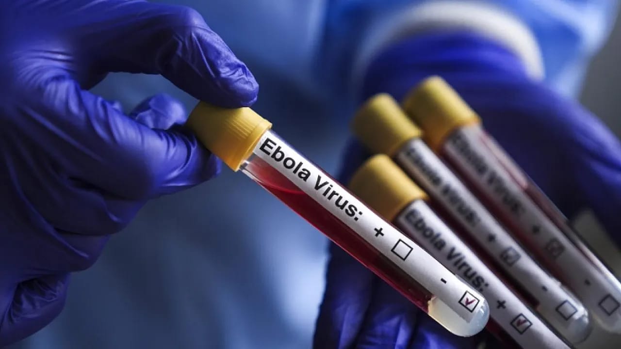 Kongo'da Ebola Alarmı Büyüyor! Vaka Sayısı 1400'ü Aştı